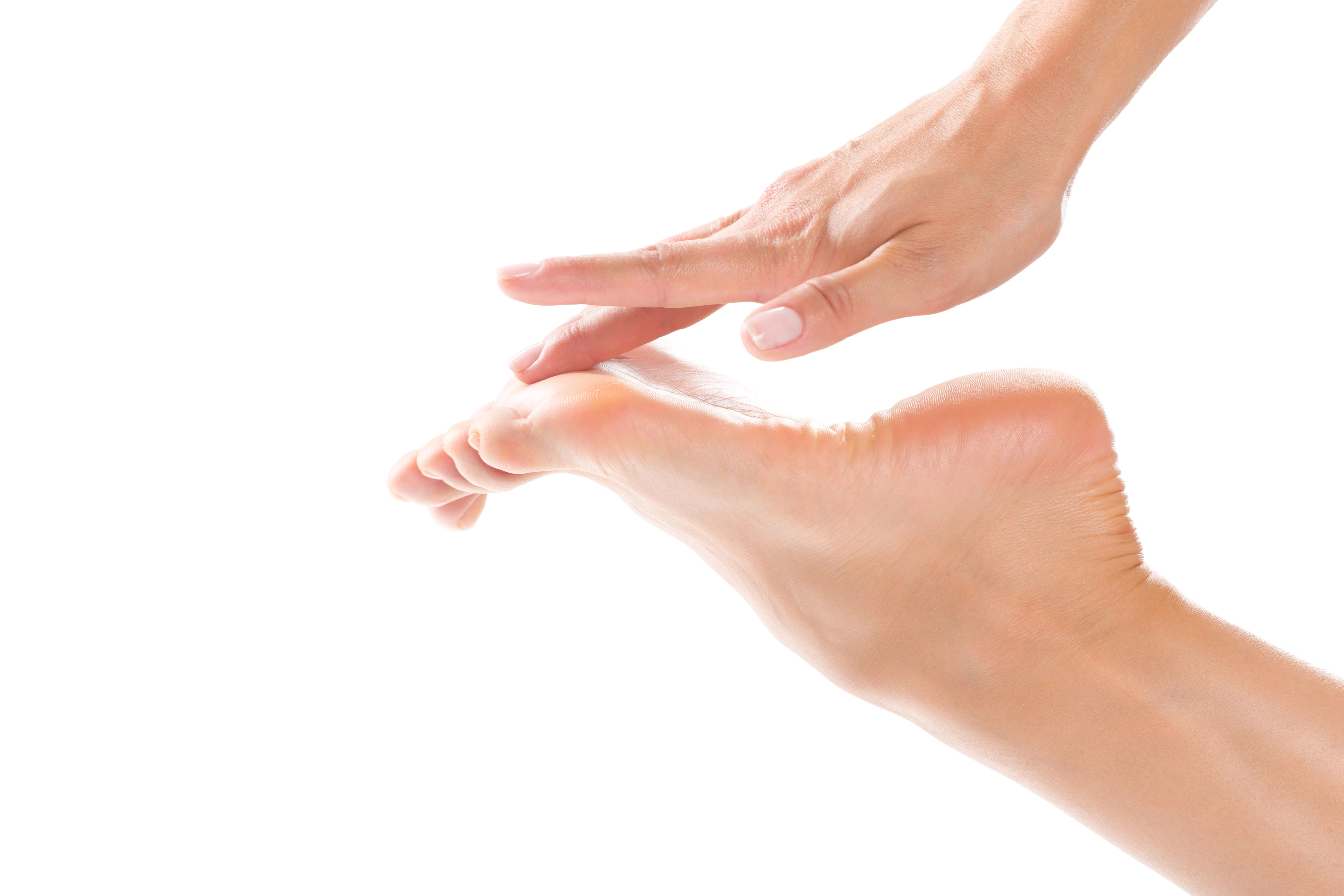 Nahaufnahme Hallux Valgus – Großzehenfehlstellung